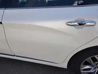 sides